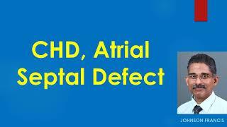 Atrial Septal Defect