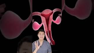 Cara pasang KB IUD, yang udah pasang sakit ga sih? #youtubehealth #dokter #shorts #kbiud