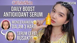 ELSHESKIN DAILY BOOST ANTIOXIDANT SERUM REVIEW | VITAMIN C 15% ??