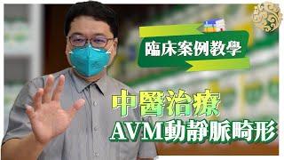 張恆偉醫師 臨床案例教學  AVM動靜脈畸形