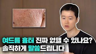 많은 분들이 궁금해 하셨던 여드름, 패인 흉터 치료에 대해 답해드립니다