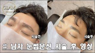 대구 남자 눈썹문신전문 대구글램뷰티본점