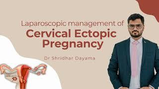 Laparoscopic Management of Cervical Ectopic Pregnancy