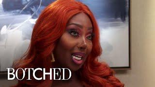 Transgender Woman Says "Duct Tape" Is Her Best Friend | Botched | E!