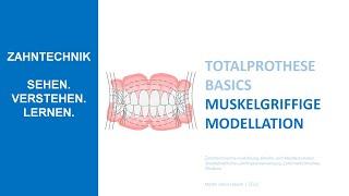 Muskelgriffiges Prothesenlayout | Herausnehmbare Prothetik