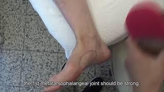047. Eng sub- Plantar fasciitis and hallux valgus, 20 year condition healed after 5 sessions