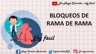 BLOQUEOS DE RAMA EN EL EKG /ECG: derecha e izquierda