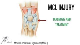 MCL tear of the knee: Injury, diagnosis, treatment