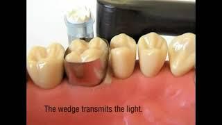 The Wedge by Polydentia SA   Dentistry