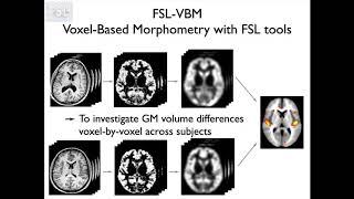 10. Segmentation: Structural Analysis using FSL VBM and SIENA (Struc E4)