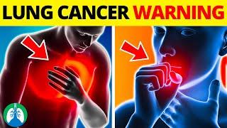 Top 10 Early Warning Signs of Lung Cancer | NEVER IGNORE THIS