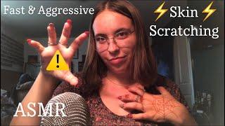 Skin Scratching Fast & Aggressive ASMR // Custom Video