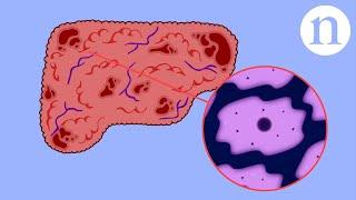 Scar wars: Repairing the liver