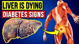 LIVER is DYING! 6 Weird Signs Diabetes is DAMAGING Your LIVER