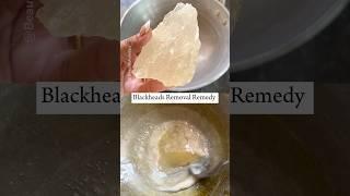 1 Day Blackheads/Whiteheads Removal, Glass Shine Nose #blackheads #skincare #beauty