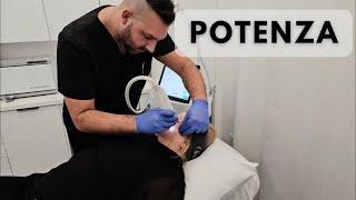 Unlocking Youthful Skin: Potenza Microneedling Explained