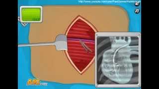 Operate Now: Pacemaker Surgery Fast Walkthrough