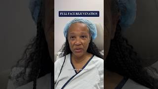 Life Changing Plastic Surgery Transformation- Full Face Rejuvenation 