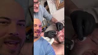 This is an EPIC cyst pop on the cheek! ‍ #trending #skincare #viralvideo