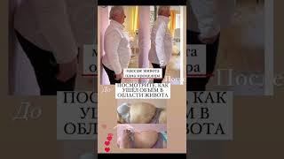 Массаж живота. Результаты от курса. #отечность#купероз #кишечник