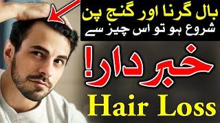 Baal Ka Girna Hair Loss baal ka girna kaise roke Dua baal girne ka ilaj baal بال گرنا Mehrban Ali