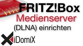 FRITZ!Box DLNA Medienserver einrichten (UPnP)