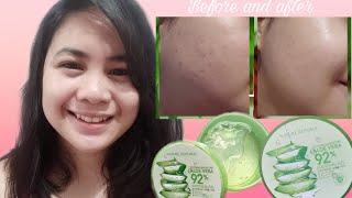 7 Benefits of using NATURE REPUBLIC Soothing and Moisture Aloe Vera Gel