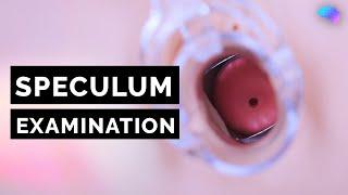 Speculum Examination | Vagina | OSCE Guide | UKMLA | CPSA | PLAB 2