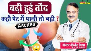 बढ़ी हुई तोंद कहीं पेट में पानी तो नहीं || ASCITIS SYMPTOMS