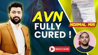 AVN Reversal Story | Normal MRI without Surgery | Ayurveda Treatment | 9424842988 | Dr Avinash Singh