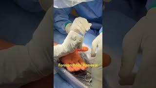 Foreign Body Removal
