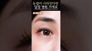 눈썹 끝이 사라진다면 병원 가세요｜갑상선 질환 초기 신호