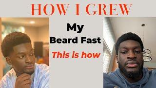 Grow a Full Beard in 6 Months with Minoxidil & Derma Roller | Step-by-Step Guide