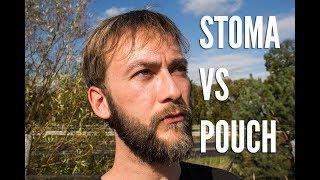 Stoma vs Pouch | Meine Vor - und Nachteile | Meine Erfahrungen