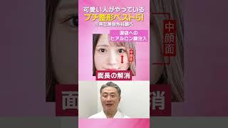 【美容整形】可愛い子はやっている？！プチ整形５選 #shorts