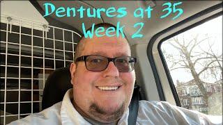 Week 2 with immediate dentures after 24 teeth extracted. Dentures at 35