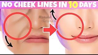 ANTI-AGING FACE LIFTING EXERCISES For Laugh Lines, Middle Cheek Lines (Nasolabial Folds/ Smile Line)