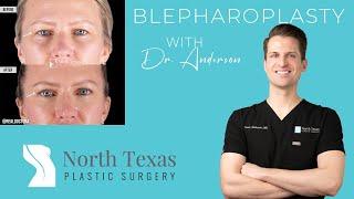 Blepharoplasty | with Dr. Casey Anderson