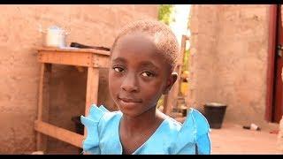 Help Kids Like Mary Who Need Life Saving Surgery - Compassion International