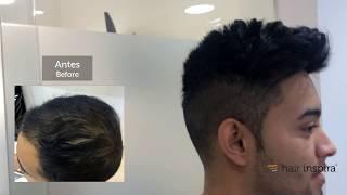 Hair Replacement fitting video (Oscar) – Hair Inspira