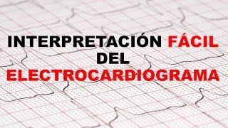 INTERPRETACIÓN FÁCIL DEL ELECTROCARDIOGRAMA 12 DERIVACIONES