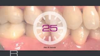 Treatment of deep periodontal pocket, Dr Laura Matrigiani and Prof Andrea Pilloni, Italy