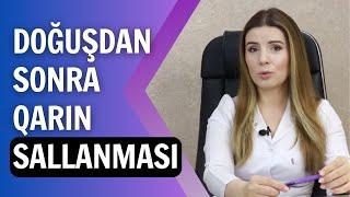 Kesardan sonra  qarın sallanması