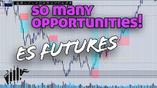 Price Action Breakdown Jan 14, 2025