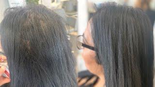 V lights hair extensions for thinning hair #thinninghairsolution #hairextensionsalon