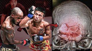 Broke His Opponents Bones! The Scariest Muay Thai Fighter Ever - Rodtang Jitmuangnon...