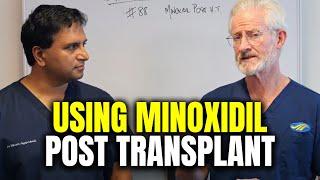 The Role of Minoxidil Post Hair Transplant