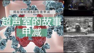 甲状腺减退---超声室的故事【Ultrasound Room】Diagnosing Hypothyroidism on Ultrasound