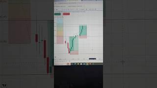 Nifty option trading today #trader #traderjoes #traderlifestyle #daytrader #daytrading #trading