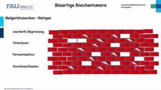 Orthopädie ─ Bösartige Knochentumore Teil 1/2